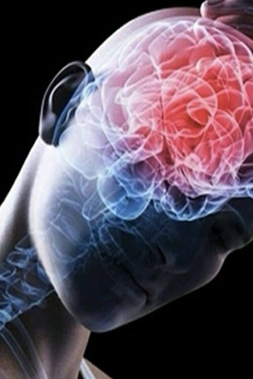 Lesión Cerebral Traumática